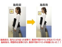 やぎはし整体院 柏駅西口店/猫背が改善したお客様