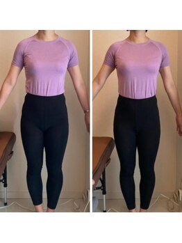 エスアップ 麻布十番店(THE S-UP)/施術前後写真