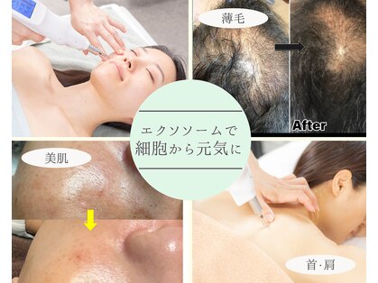 リソルブ(Resolve)の写真