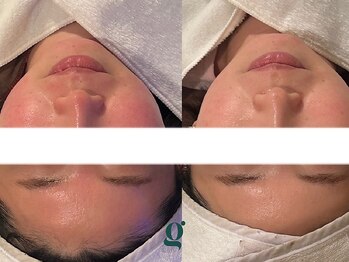 グレイスリリー(grace lily)/