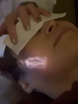 シミしわ改善！予防ケア