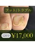 【初回】トラブル爪+育成ケア(120分)