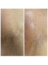 アットユウ(@yu)/フェムエステ