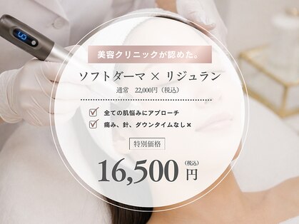 オニュ(onyu)の写真