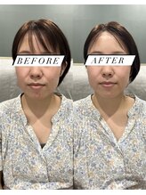 シロ(silo.)/スペシャリティケア