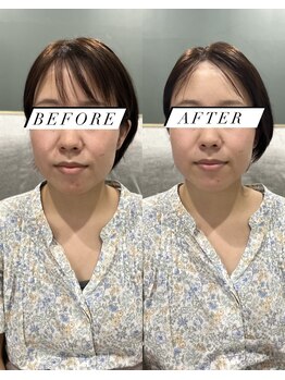 シロ(silo.)/スペシャリティケア