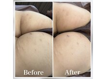 リリ(LiLi)/ビオフィート・ビフォーアフター