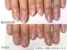 白い爪ばかり伸びる平爪が約4か月で縦長の爪へ変化※ジェル無