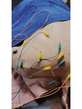 創整はりきゅう院/背中や肩の痛み