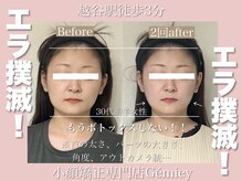 ジェイミー(Gemiey)の雰囲気（エラボト卒業するお客様続出中！越谷/小顔/小顔矯正/越谷小顔）