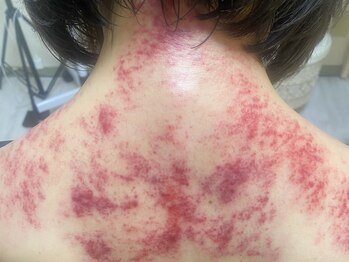 コル コルエ(koru korue)/高めの血流も改善?!