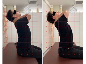 トワニ整体 新富町院(TOWANI整体)/肩こり/銀座/新富町/築地/整体