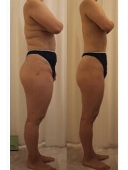 ファニービー 茨木本店/Before→After