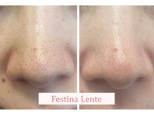 フェスティナ レンテ(Festina Lente)