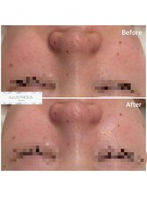 クレア(Clair)/イラストリアス症例