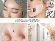クリード(CLEAD)