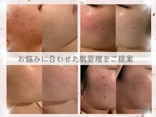 カレンジェビューティー(CarengeBeauty)