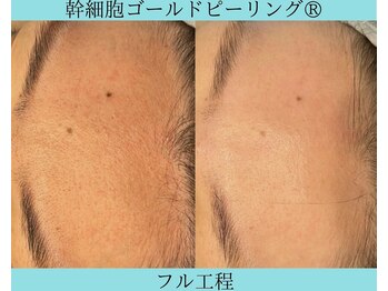 リメイククリニカルビューティー(Remake clinical beauty)/