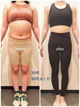 24ダイヤモンドジム(24 DIAMOND GYM)/before/after