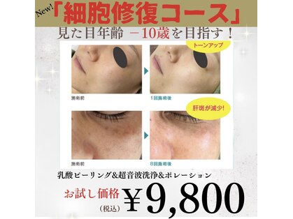 レイカ(Reica)の写真