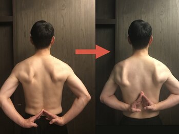 サロンコスメティック ザ スパ(SALON COSMETIC THE SPA)の写真/ガチガチ肩甲骨のコリをケア！巻き肩・猫背のお悩みに◎微弱電流でスッキリ♪