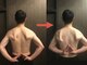 サロンコスメティック ザ スパ(SALON COSMETIC THE SPA)の写真/ガチガチ肩甲骨のコリをケア！巻き肩・猫背のお悩みに◎微弱電流でスッキリ♪