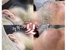 アルゴ 福津店(ALGO)の雰囲気（【Wax脱毛】ワックス×光脱毛で即日ツルスベ肌に♪）