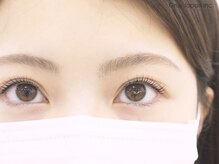 グルス(GRUS)/Wプロテクトカール