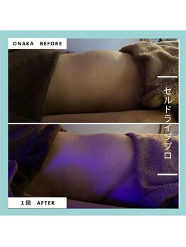 ジュネラ ボーテ(Jenela beaute)/痩身