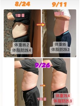 サンタイ(santai.)/Wキャビテーション