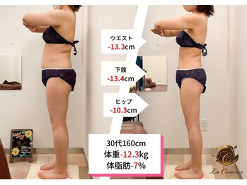 ラ コンシェル 三軒茶屋店/Before after【三軒茶屋店】