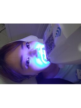 美白ケアをしたい