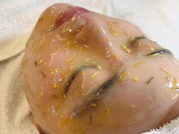 リエラ(Riela)/◇施術イメージ◇