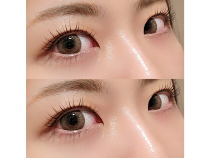 ジゼル(Giselle)の写真
