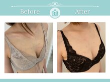 美人バスト 沼津店/【バストアップ★育乳】症例！！