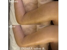 インディバサロン アンド(&.)の雰囲気（他店で効果のなかった方◎適切な施術でDTの不安を解消いたします）
