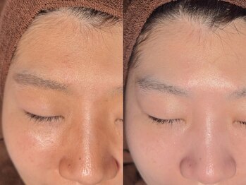 ルーナジェーナ(Luna llena)/池袋/目白/雑司ヶ谷/エステ