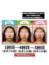 小顔整体研究所 KSラボ 新潟中山店/