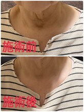 レナティス(Renatis)/