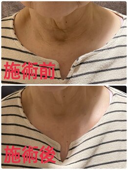 レナティス(Renatis)/