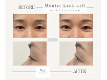 プリュ(Pul)/まぶたドレナージュ目元スッキリ