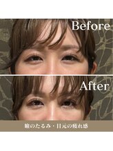 カリスタ 恵比寿駅前店/継続的な施術による変化