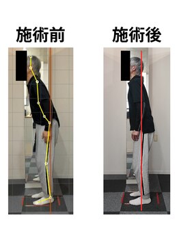 スタイルフリー/60代男性腰痛