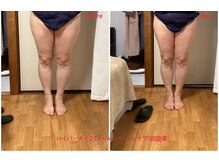 ミュー 新小岩店(Mieux)/Wマシン1回効果