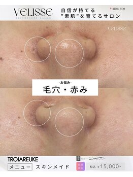 ヴェリス 福岡店(Velisse)/