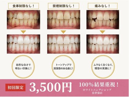 ホワイトニングショップ 佐世保店の写真