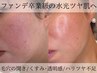 【韓国式肌管理】セルマン肌体験☆ノーファンデを目指す魅せ肌へ22000円⇒