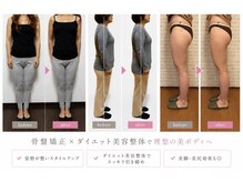 練馬アカデミア美容整体院の雰囲気（マンジャロに頼らず骨盤矯正で健康に綺麗痩せ美容整体 練馬駅2分）