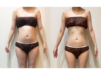 アネル 浦添店(anel)/