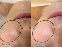 エビアス(Evias)/触りたくなるさらさら肌へ